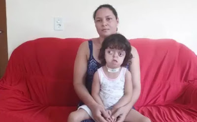 Deu no G1: Menina de 5 anos com doença rara precisa de ajuda após passar por 13 cirurgias, em Campos Belos