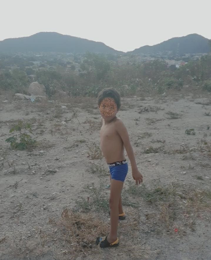 Campos Belos (GO): criança especial, com microcefalia, necessita de fraldas descartáveis