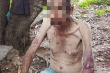 Drama humano e familiar: em Flores de Goiás, idoso é resgatado em situação de maus-tratos; filhos são alcoolátras
