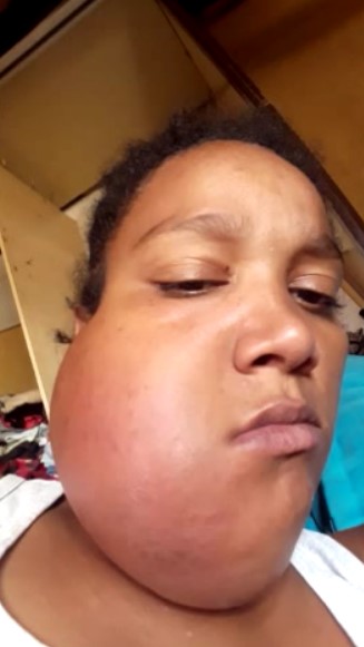 Desespero: em Campos Belos (GO), jovem mãe, com câncer na boca, pede socorro
