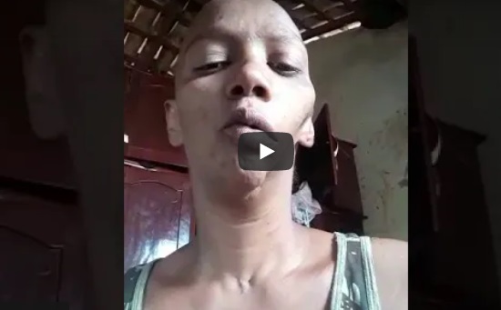 Com câncer, Janaína Bento está sem dinheiro até para alimentação