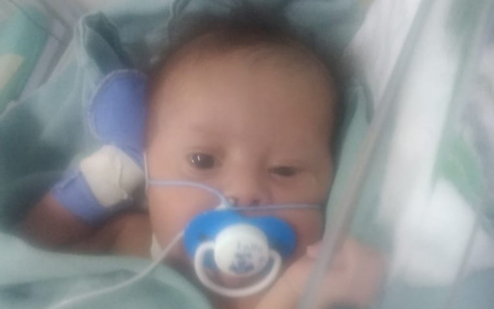 “Deu no G1”: de Campos Belos (GO), bebê com síndrome de Down está internado e precisa de leite especial que custa R$ 130 a lata
