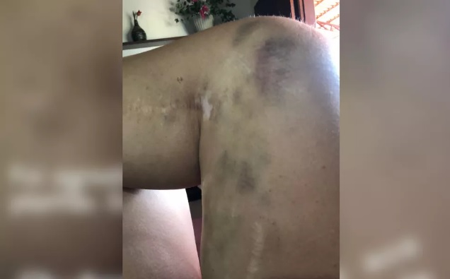 Médica é agredida com chutes por filha de paciente durante plantão em hospital de Monte Alegre de Goiás (GO)