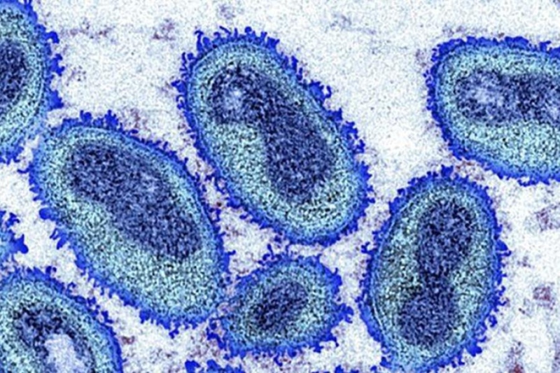 Goiás tem 315 casos confirmados de varíola dos macacos