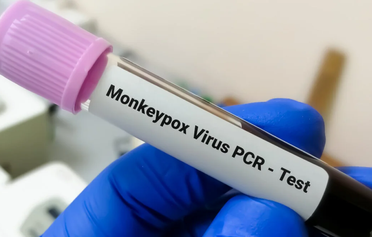 Sobe para 250 número de casos confirmados de varíola dos macacos em Goiás