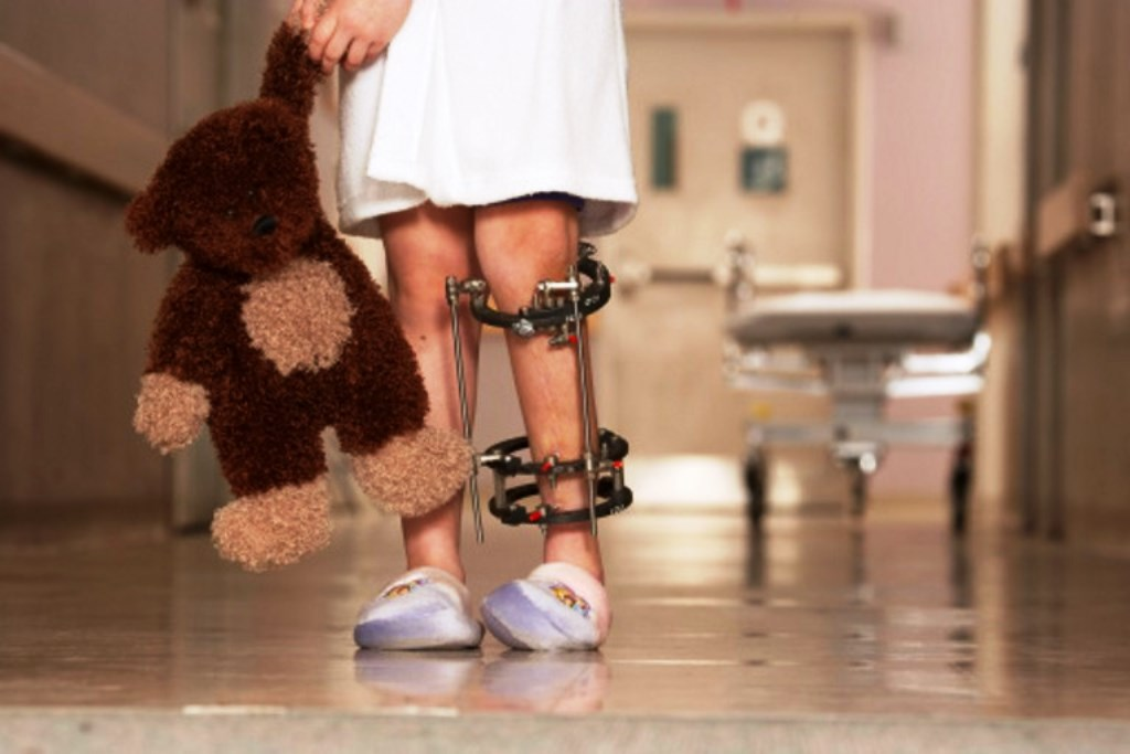 Poliomielite: muito além das gotinhas e da paralisia das pernas