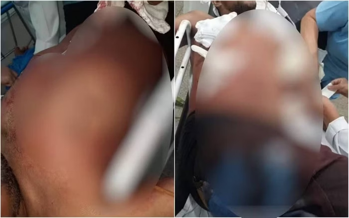 homem é assassinado em Minaçu (GO), após passar mão nas nádegas de mulher em bar