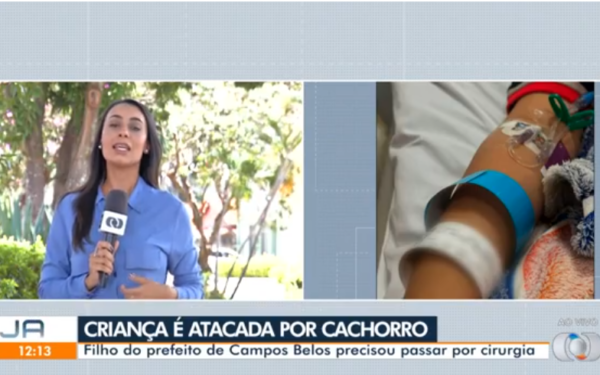 Jornal Anhanguera, da TV Globo Goiânia, destaca ataque de cachorro que feriu filho do prefeito de Campos Belos (GO)