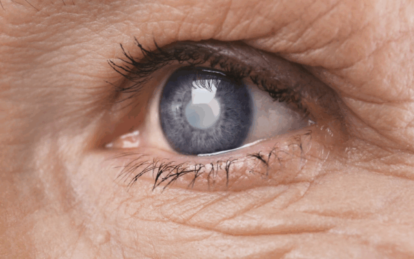 Dia Nacional de Combate ao Glaucoma Prevenção exige acompanhamento regular a partir dos 40 anos